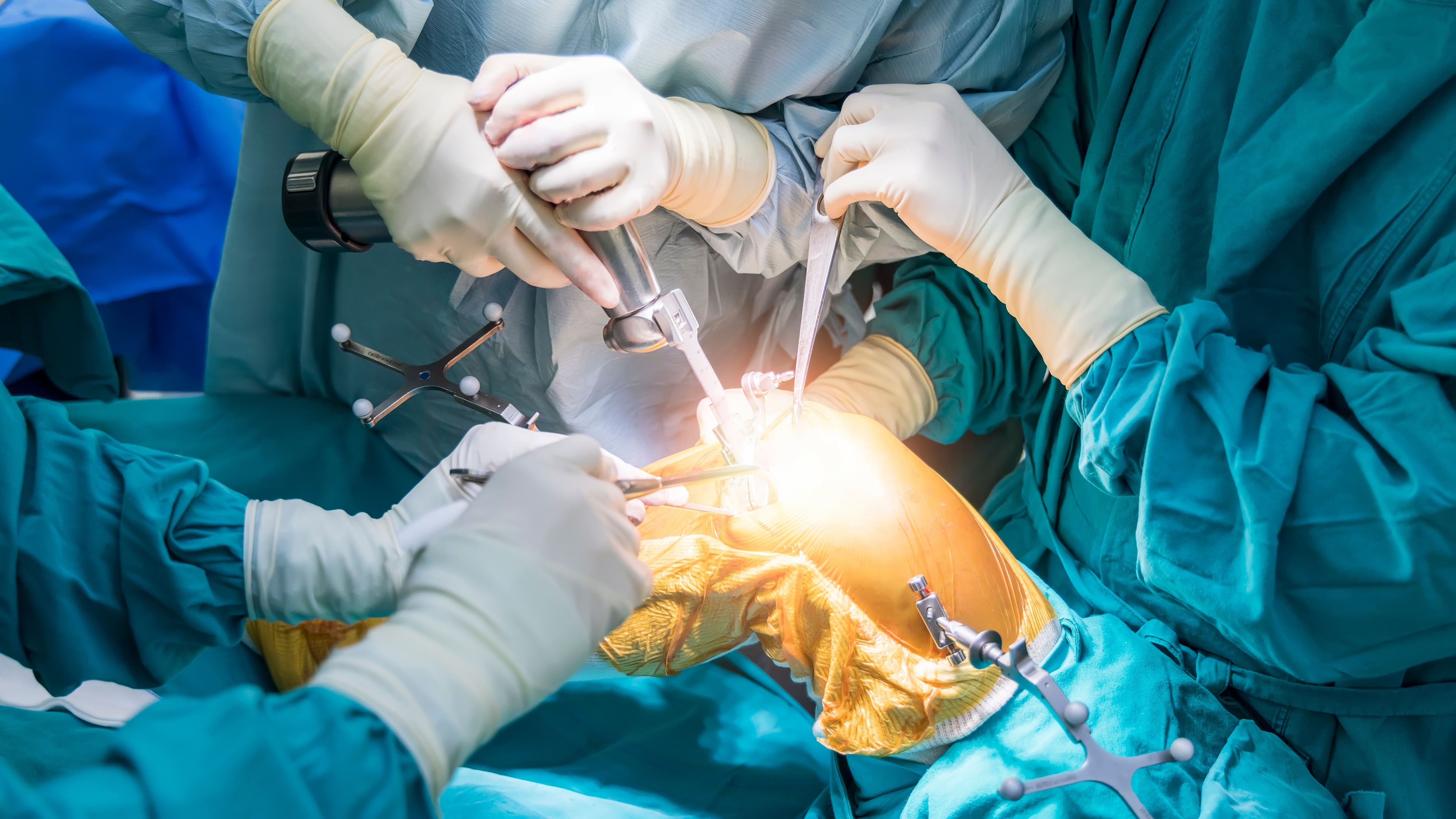 Total knee replacement