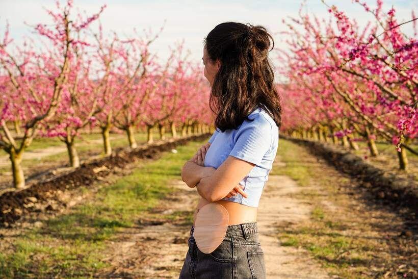 

En quoi une ceinture de soutien abdominal améliore-t-elle la qualité de vie des patients stomisés ?

