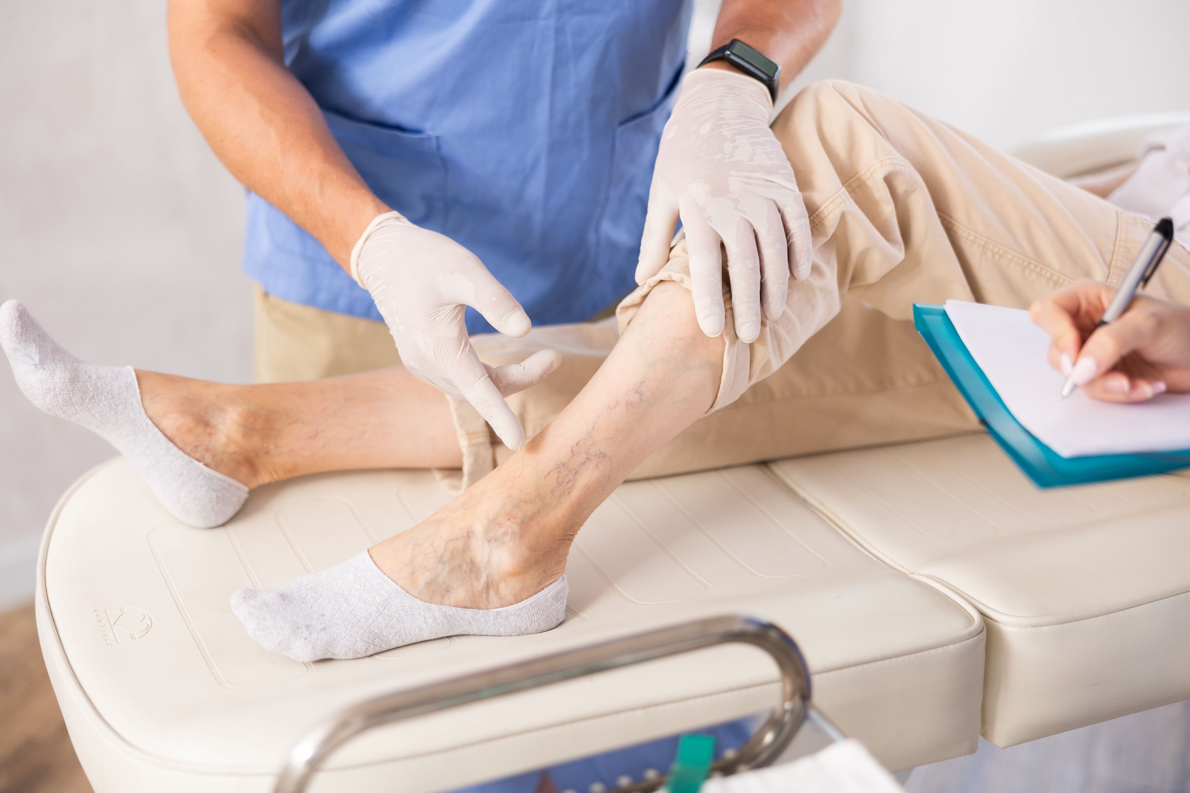 Signs of venous insufficiency: who and when should you consult ?